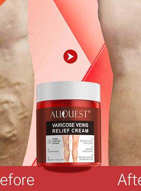 AUQUEST Varicose Veins Relief Cream Vasculitis Phlebitis Spi
