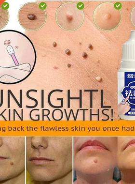 1pcs Skin Tag Remover Genital Wart Treatment Instant Removal