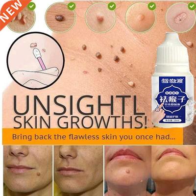 1pcs Skin Tag Remover Genital Wart Treatment Instant Removal