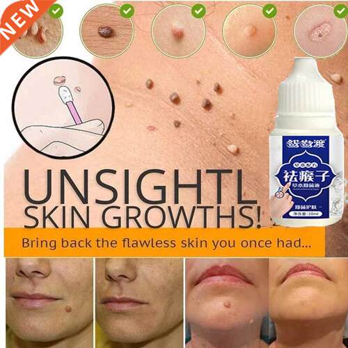 1pcs Skin Tag Remover Genital Wart Treatment Instant Removal