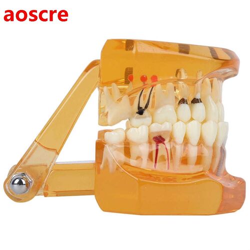 1pc Orange Color Dental Disease Study Removable Teaching Tee