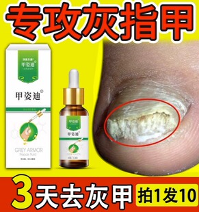 灰指甲专用抑菌液治疗冰醋酸脱趾的甲姿迪凤仙花旗舰店
