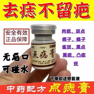 点痣膏无痕点斑去痣水志脸部专用除去黑痣祛膏正品药房旗舰店正品