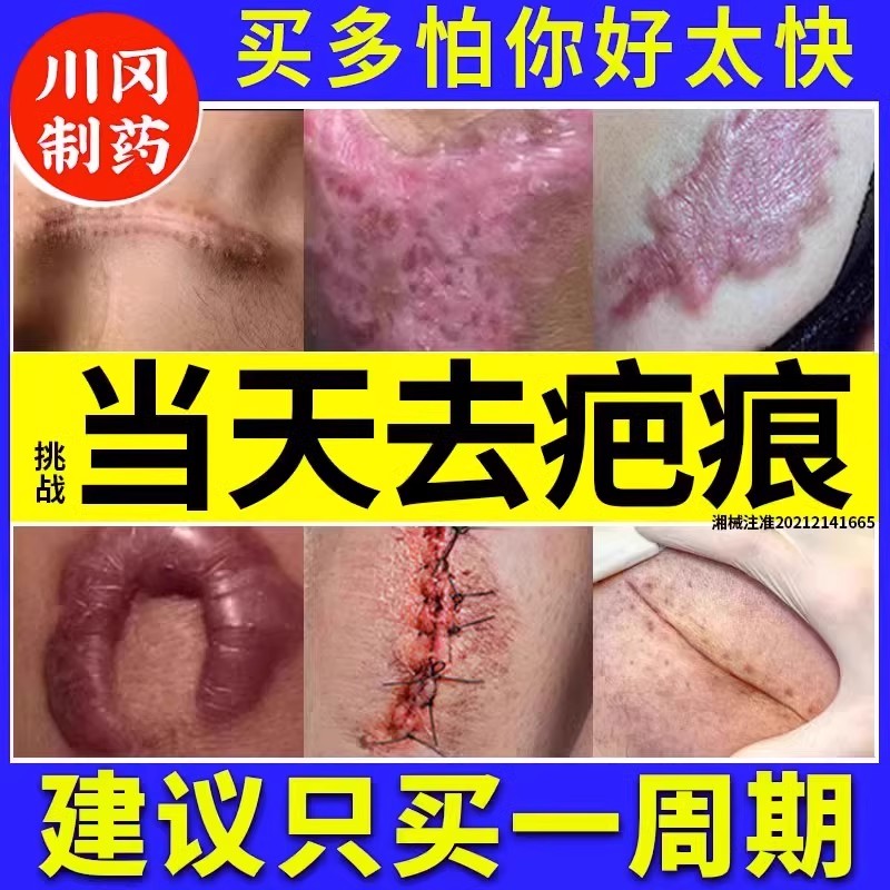 日本进口祛疤膏去疤痕修复除疤膏医用硅酮凝胶剖腹产手术烫伤儿童 医疗器械 祛疤产品 原图主图