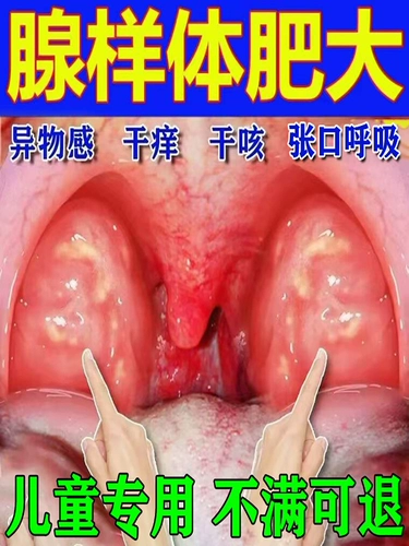 [Дети, посвященные] Железная гипертрофия дети, застой назального, открытый рот, дыхание, храп зубов, выступающий JZ