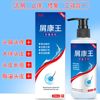 去屑止痒洗发水屑康王去严重头皮痒除螨大块头皮屑专用控油洗发露