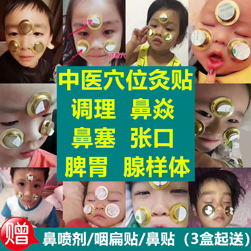 小儿童成人鼻炎艾灸贴盒无烟神器过敏性鼻窦炎鼻塞喷雾腺样体肥大