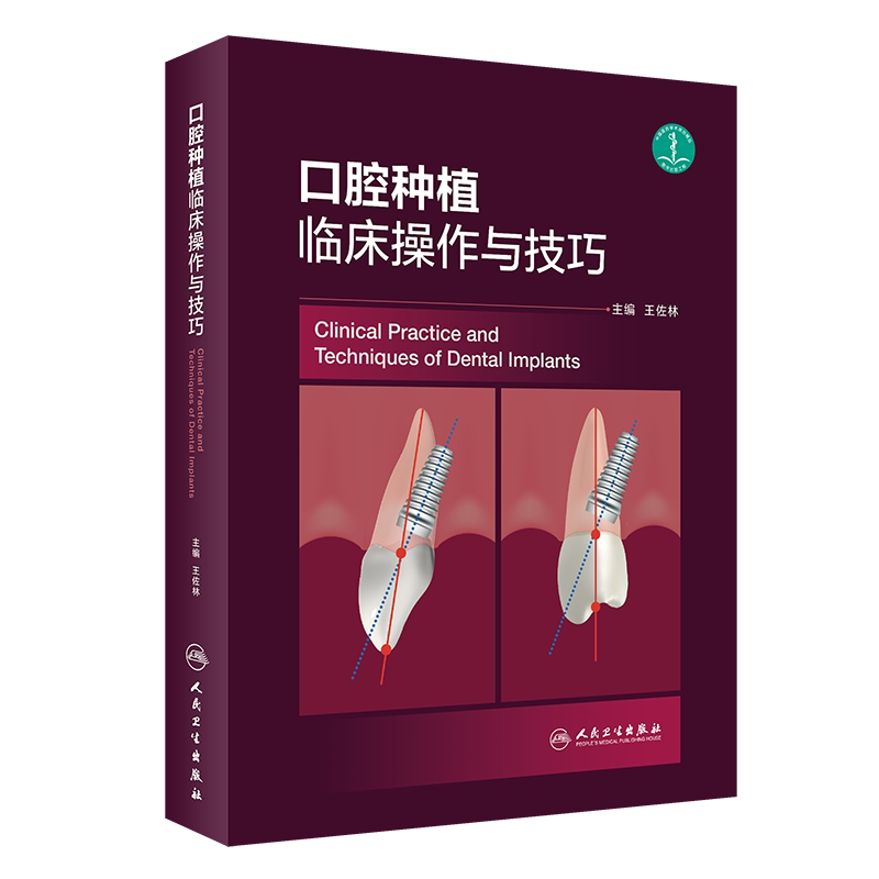 现货 口腔种植临床操作与技巧 王佐林 种植学倾斜书籍种植牙现代的精准植入技巧二期手术和取模大全美学区重建并发症全牙列修复书