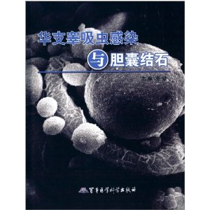 华支翠吸虫感染与胆囊结石