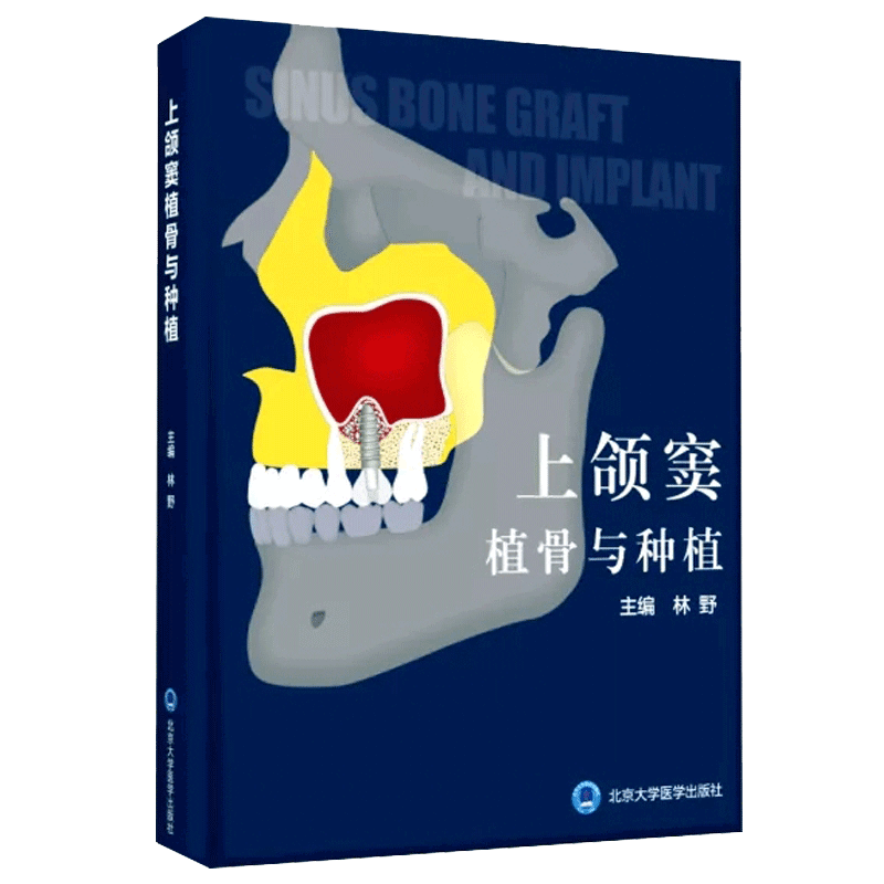 正版现货上颌窦植骨与种植林野口腔科口腔种植学书牙科修复精准植入技巧口腔修复种植牙手术学图解美学区域现代牙科种植体影像
