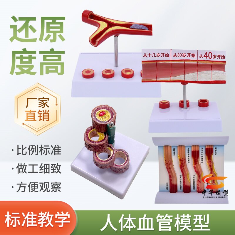 心脑血管堵塞模型关节血栓血液浓度脂肪病理粥样硬化人体解剖教具