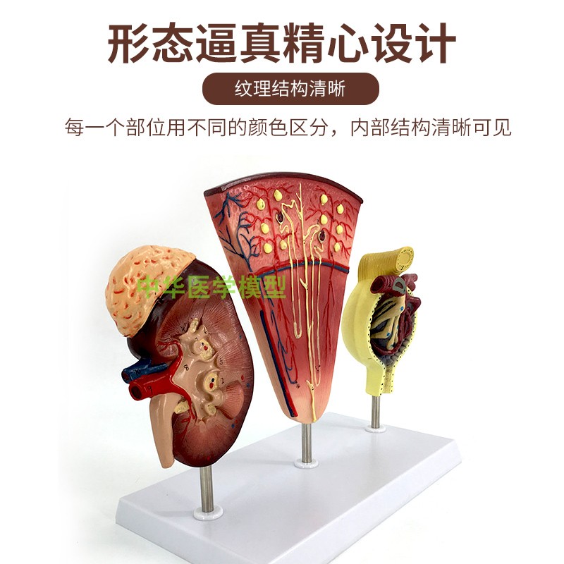신장 및 네프론 사구체 확대 모델 신장 해부학 모델 인간 신장 모델 내장 해부학
