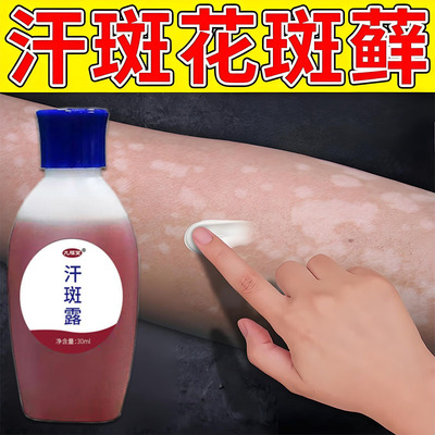 九福堂汗斑露腋下汗多后背手臂肩膀小白点全身皮肤可用汗斑净