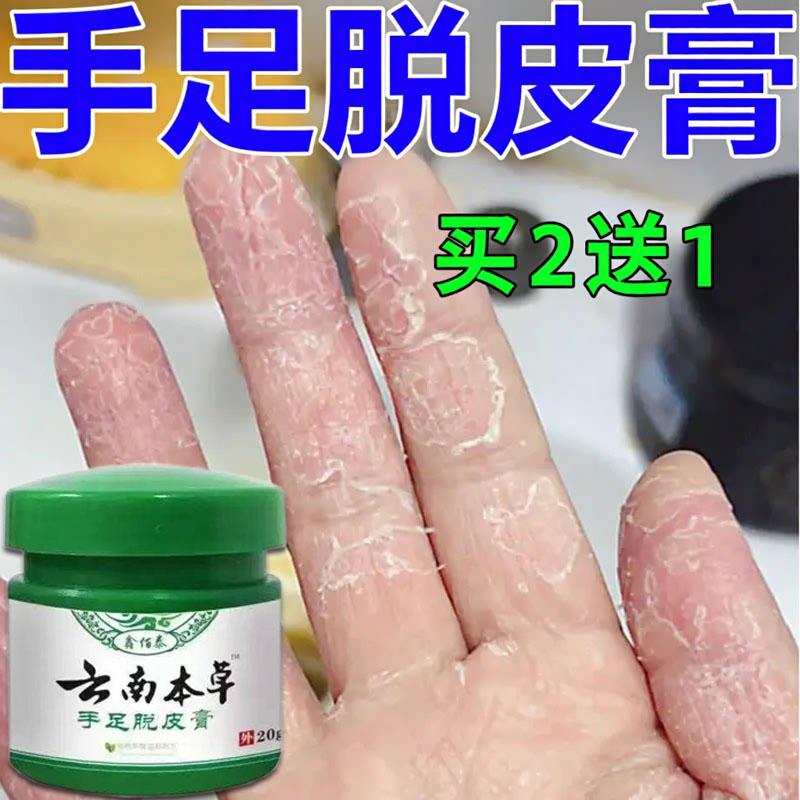 手足脱皮膏正品手指脚底起皮干燥手掌蜕皮脚底手脚掉皮男女通用