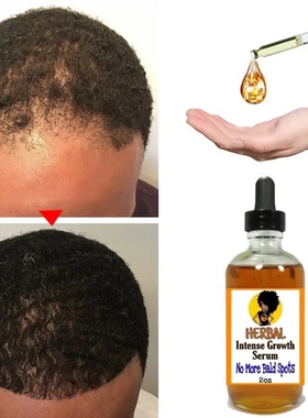 HERBAL Black Seed Castor Oil Hair Growth Serum Fast Growth