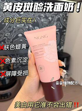 正品NGNG美白祛斑洁面乳150g淡斑提亮肤色改善暗沉舒缓盈润洗面奶