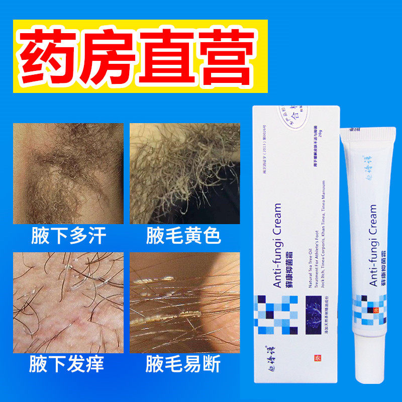 腋毛癣白色附着物液毛腋窝藓去清洗膏喷雾炎毛囊除清理腋下瘙痒CY