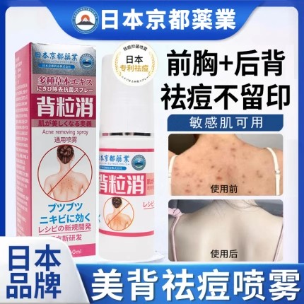 日本京都背粒消喷雾祛痘