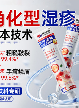 角化型湿疹鹅掌风手足癣膏手裂脱皮干裂痒真菌感染顽固皮炎专用FK