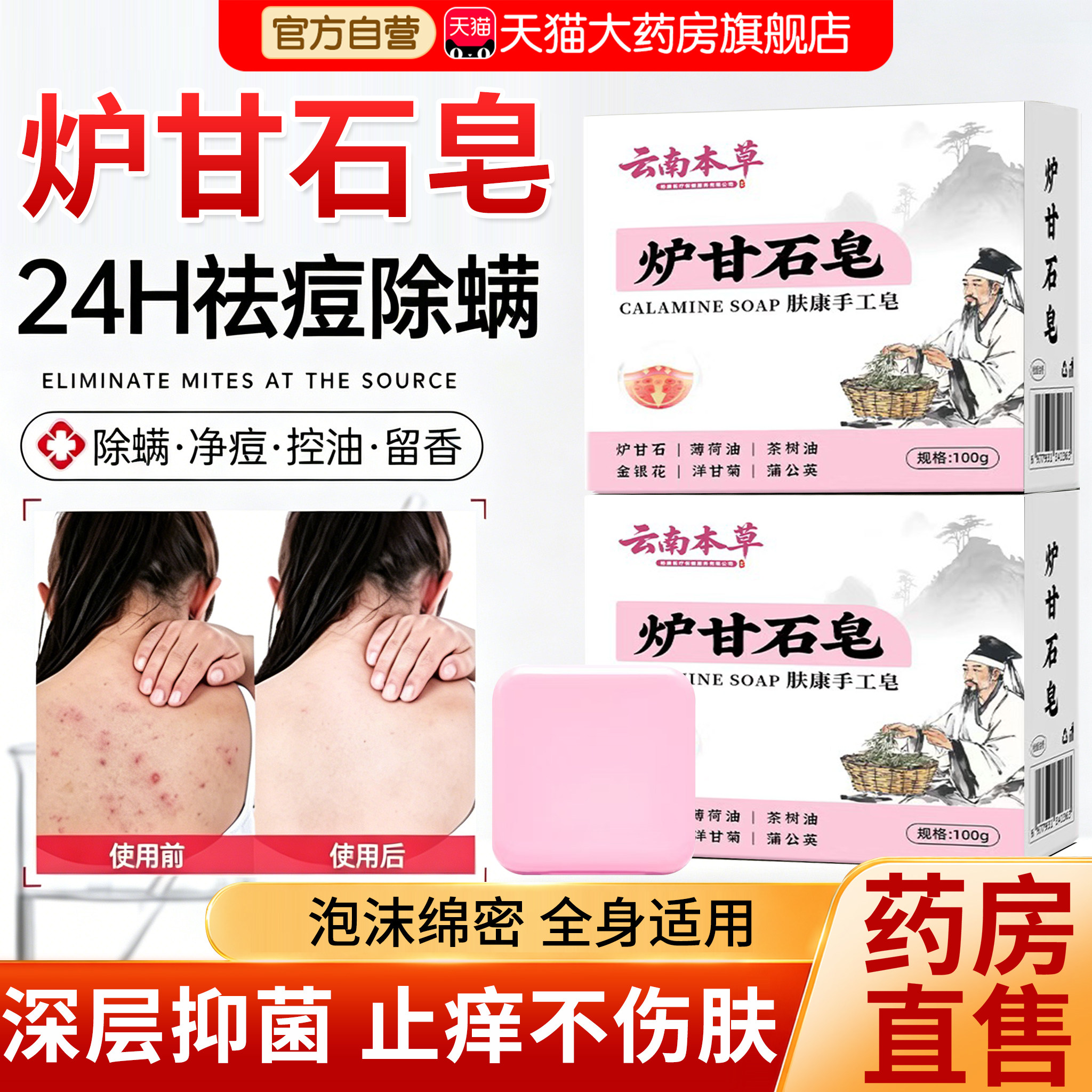 炉甘石香皂医用级背后痘除螨抑菌瘙皮肤痒官方旗舰店正品er