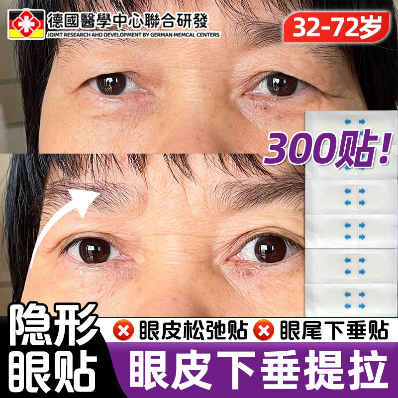 【眼皮眼尾提拉贴】中老年人定型