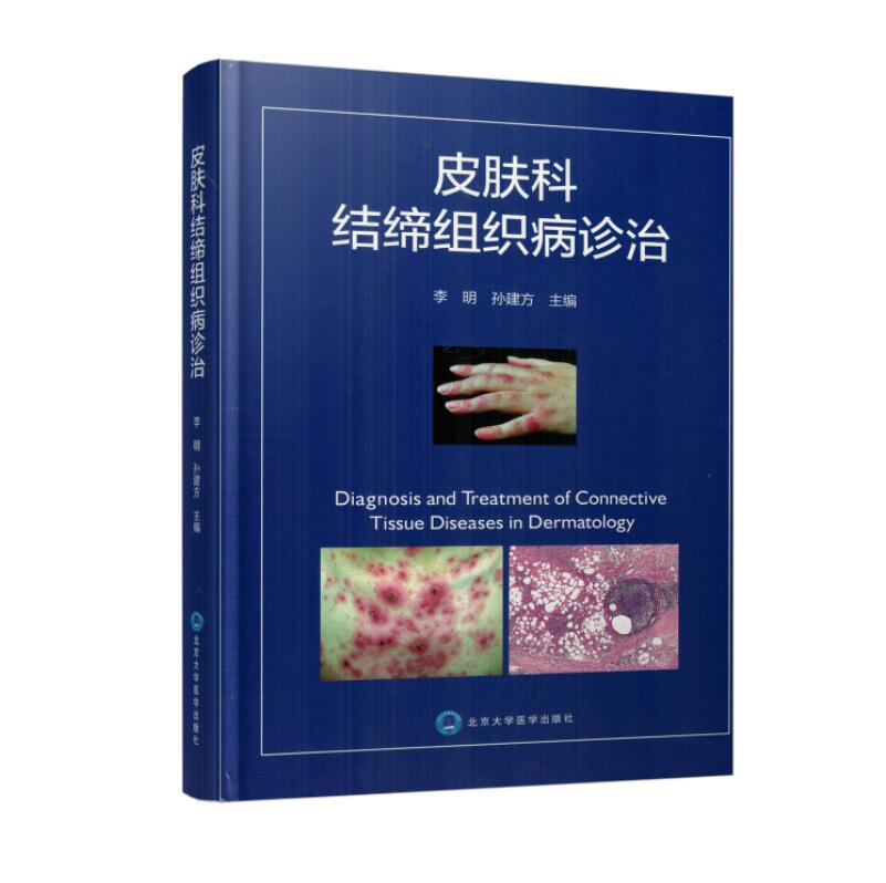 现货 皮肤科结缔组织病诊治 李明 孙建方主编 北京大学医学出版社