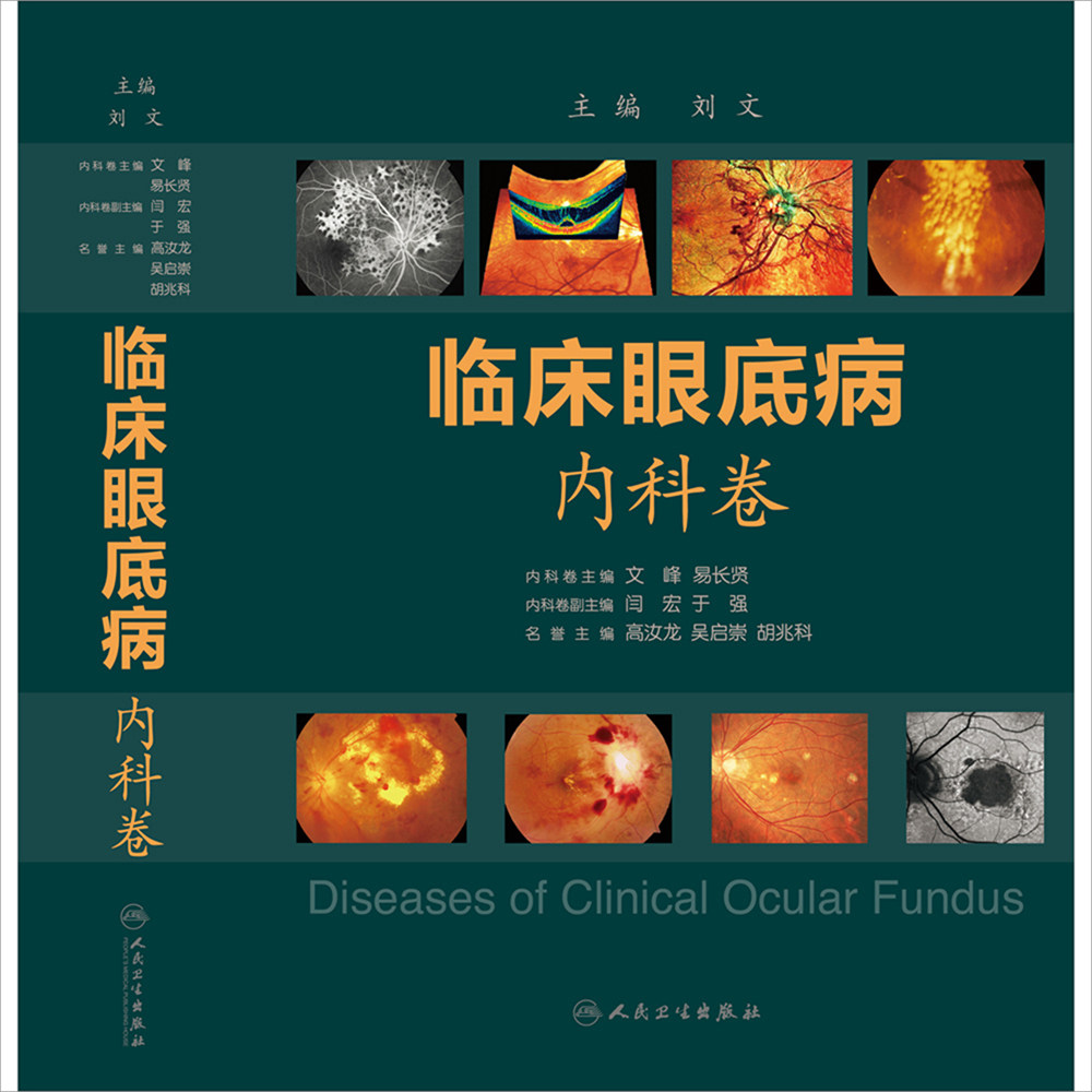 正版现货当日发 临床眼底病.内科卷 文峰 易长贤主编 人民卫生出版社 眼科学