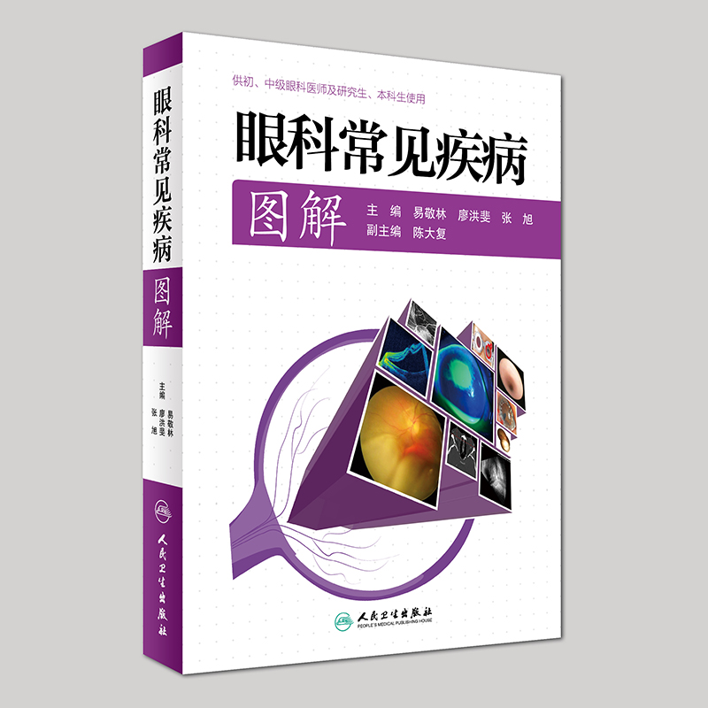 现货 眼科常见疾病图解(供初、中级眼科医师及研究所、本科生实用)易敬林,廖洪斐,张旭主编 人民卫生出版社