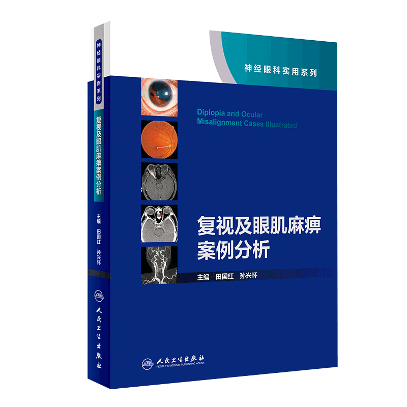 现货 复视及眼肌麻痹案例分析神经眼科实用系列眼科疾病书籍人民卫生出版社田国红孙兴怀9787117305334