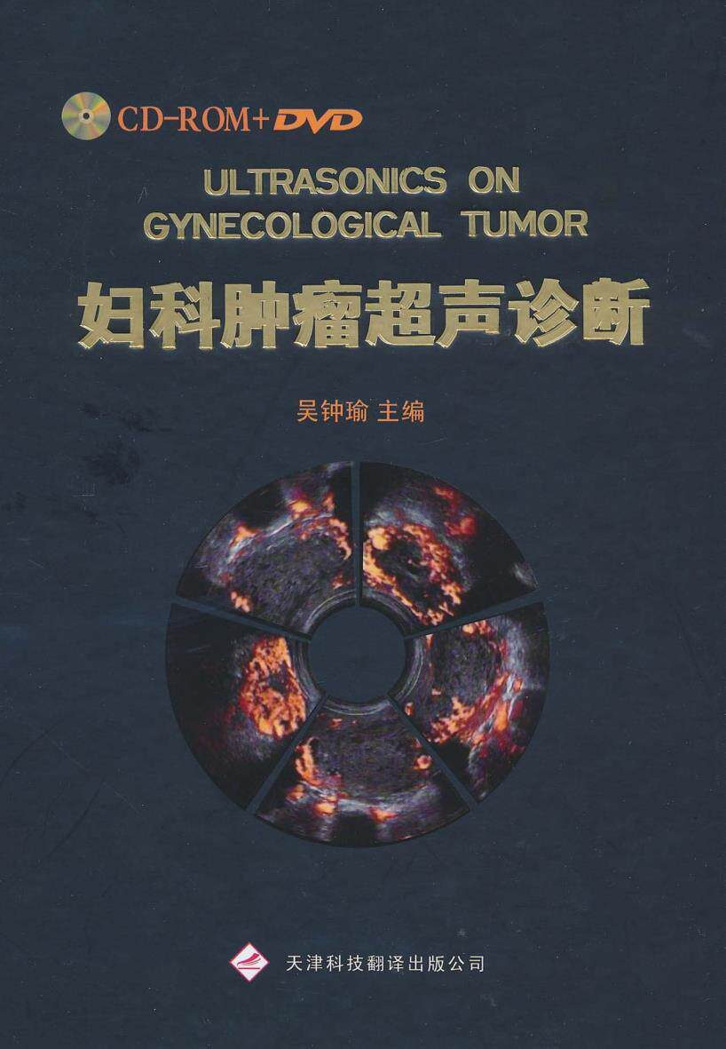 ★妇科肿瘤超声诊断（CD-R+DVD）吴钟瑜/天津科技翻译出版公医学 医疗器械及使用
