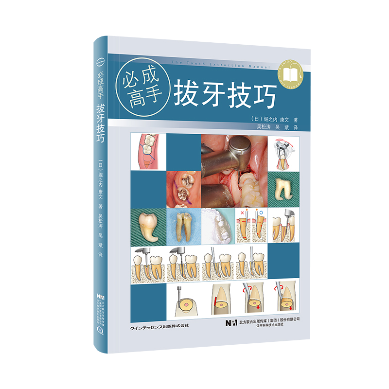 现货现货拔牙技巧必成高手