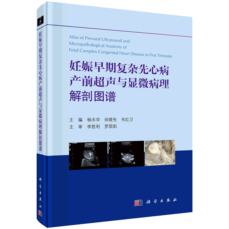 现货妊娠早期复杂先心病产前超声与显微病理解剖图谱科学出版社