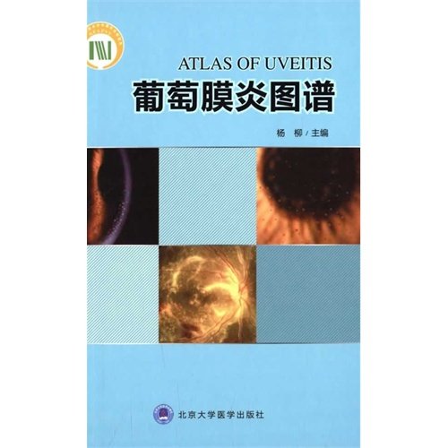 葡萄膜炎图谱 杨柳主编 北京大学医学出版社
