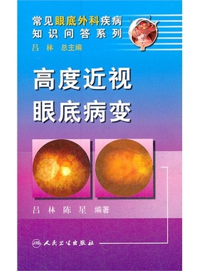 现货 Diabetes - Ayuda de la medicina china -- Guía ilus 人民卫生出版社