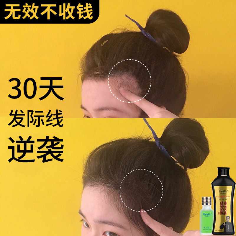 【小紅書達人推薦】頭發自然快速生長 頭發變多變密變長 男女通用在類目 美髮護髮/假髮, 洗髮護髮（新）, 洗髮水中 - 來自Buy2taobao.com提供專業的淘寶代購服務