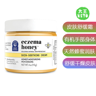 美国直邮 ECZEMA HONEY Original Skin-Soothing Cream皮肤舒缓霜