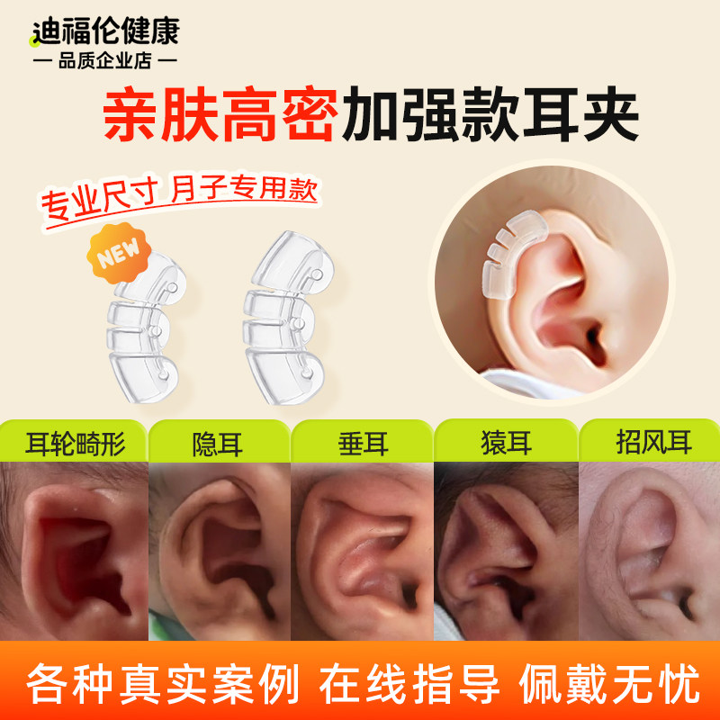 耳朵矫正器新生婴儿耳廓矫形器支撑神器耳夹宝宝定型贴医院同款