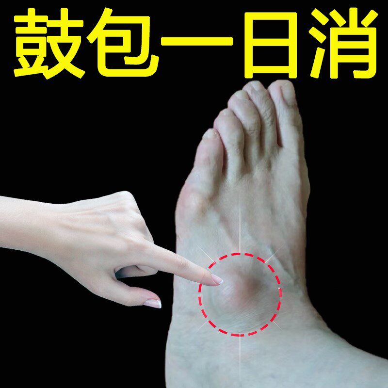 脚背筋膜炎疼痛脚面脚踝腱鞘囊肿鼓包肿痛扭伤僵硬酸痛专用膏药贴