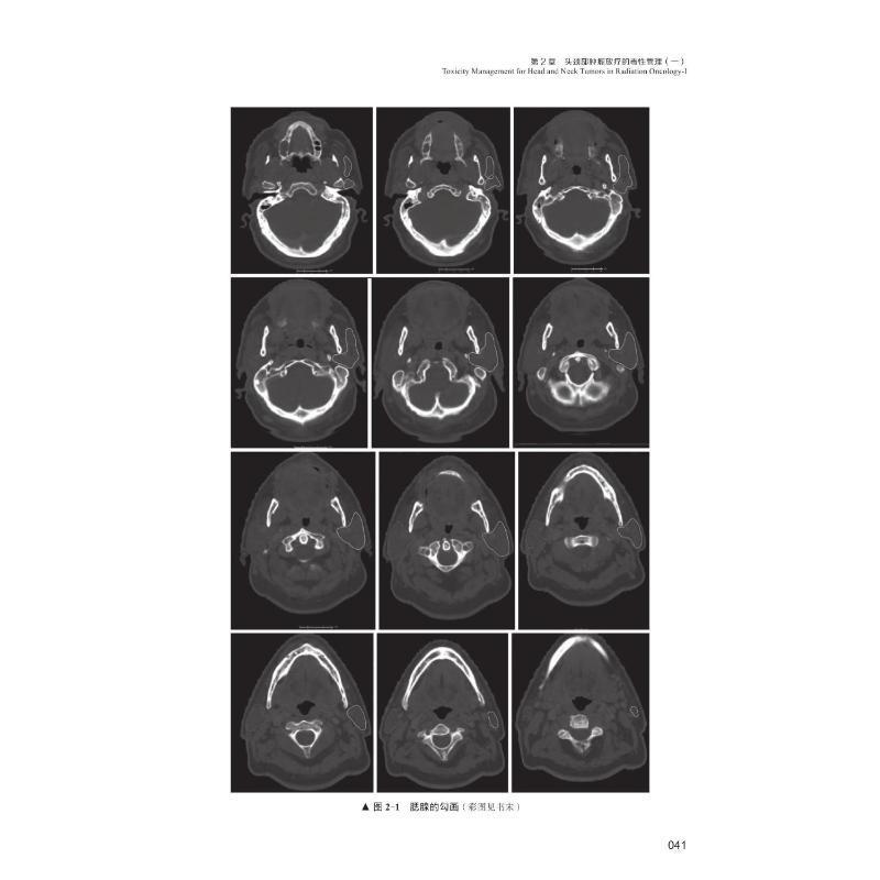 放射学急与晚期毒的:放射学中的毒管理:management of toxicities in radiation oncology  书医药卫生书籍