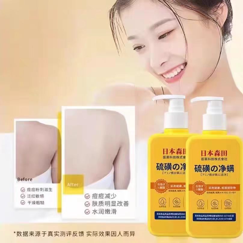日本森田硫磺除螨皂液深层清洁水油平衡祛痘修复肌肤保湿