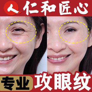 眼霜抗皱去细纹眼角皱纹修复眼纹鱼尾纹紧致眼精华淡化黑眼圈眼袋