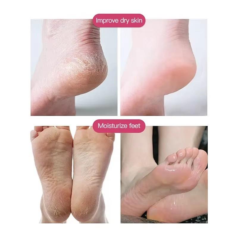 Sox wet water treatment socks, female foot-care care for dry