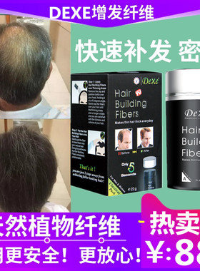 DEXE英国头发纤维粉增发喷雾假发际线填充秃顶稀疏补发缝遮盖神器