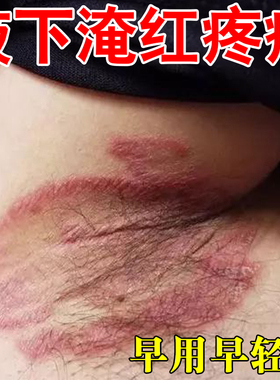 腋下痒腋窝红肿起小疙瘩痒红咯吱窝异味出汗发臭红斑淹红瘙痒泛红