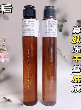 姣后寡肽冻干基底液舒缓敏感改善痘印维稳提亮水润清爽精华200ml
