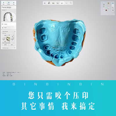 咬模工具包下单送矫正模拟动画（联系客服拍下，自动拍无效）2