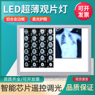 超薄X光观片灯箱医用led看片灯箱阅片灯三联看观片灯双联骨科核磁