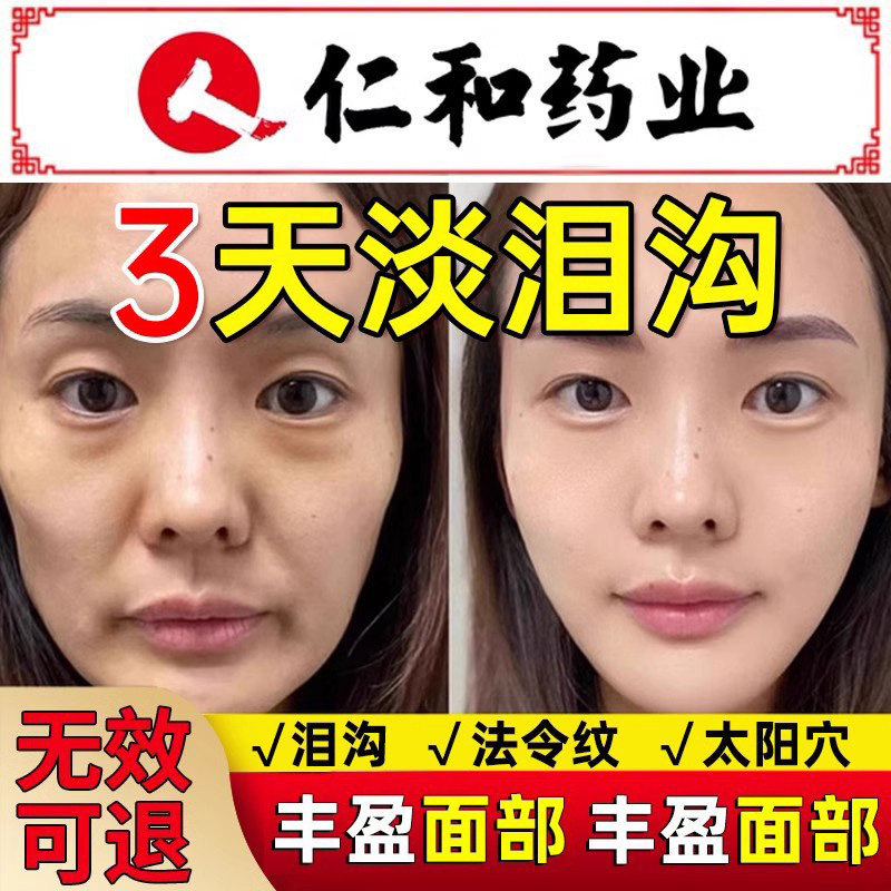 泪沟填神器丰盈额头太阳穴眼窝脸颊淡法令纹鱼尾纹眼部精华充
