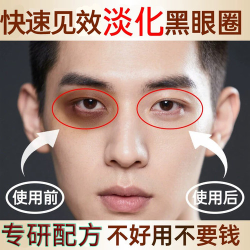 男士专用淡化黑眼圈眼霜药企专研