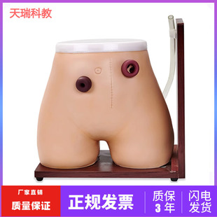 造口模型 高级瘘管造口术护理模型 结肠回肠造瘘教学模型  造口冲